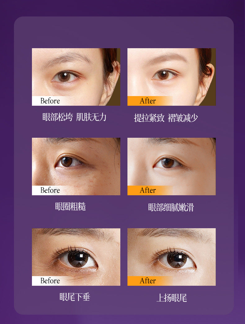 Dailaiyan Recombinant Collagen Exquisite Wrinkle Smoothing Eye Essence Oil Anti-Wrinkle Exquisite Softening Moisturizing Softening Eye Oil