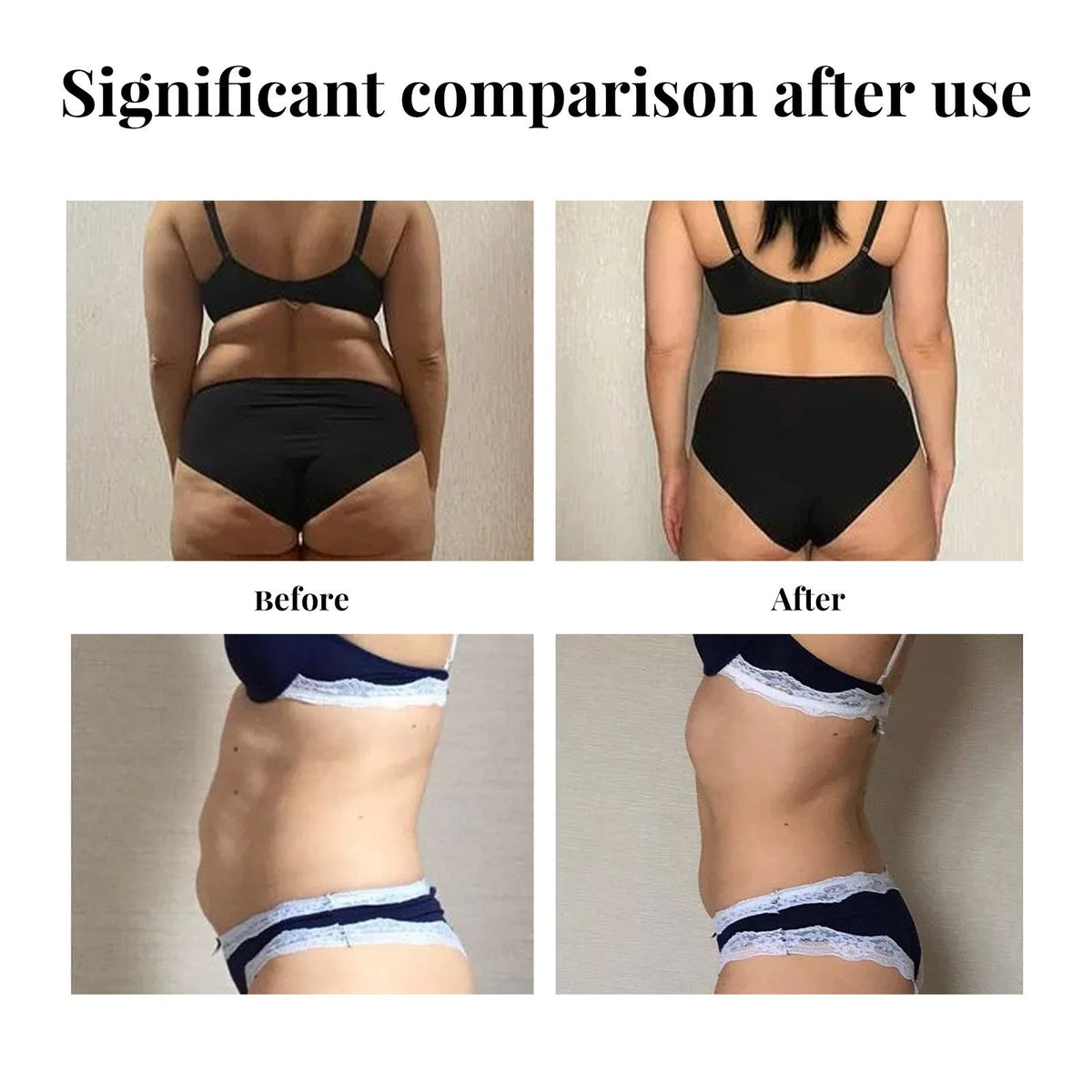 Abdominal Lifter Loose Skin Firming Slim Fit